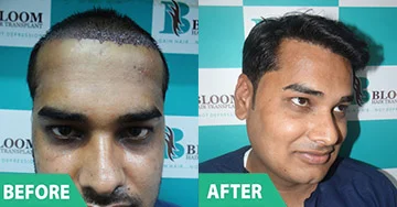Before and After 5