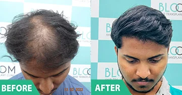Before and After 1