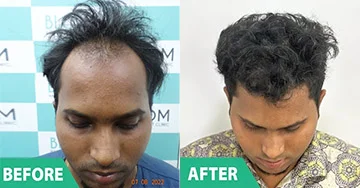 Before and After 6