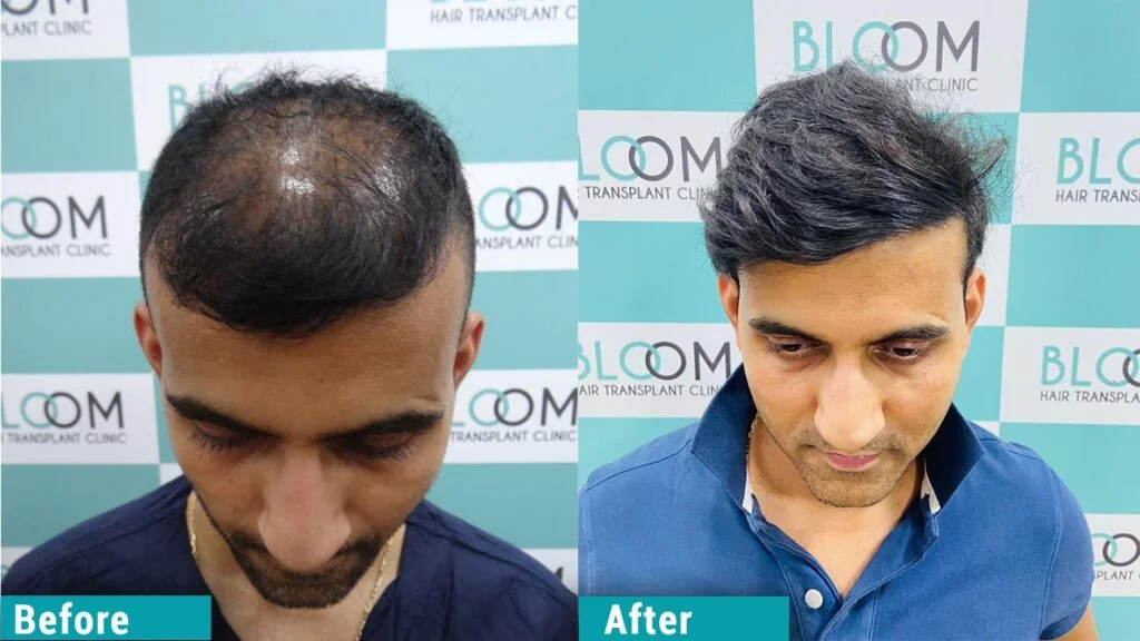 Before and After 3